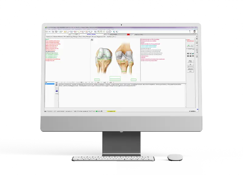 Recording a treatment in the practice management software ‘x.isynet’